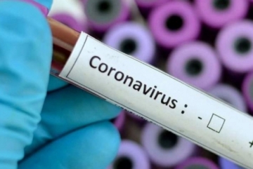 5 death cases caused by coronavirus infection recorded in Abkhazia